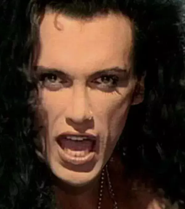 Pete Burns. Der britische Pop-Sänger hatte sich unzählige Male unter's Messer gelegt...