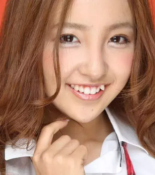 Schiefe Zähne - In Japan gehört es zum guten Ton, nicht nur gerade Zähne zu haben. Wer mit perfekten Zähnen geboren wird, lässt sich sogar manchmal seine Zähne umrichten!