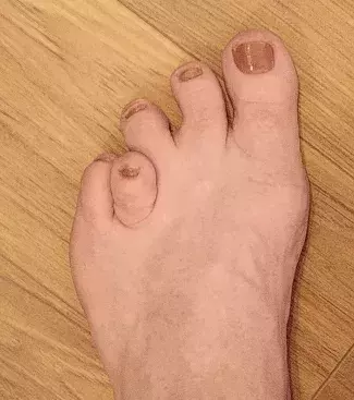 Schon einmal solche Füße gesehen?