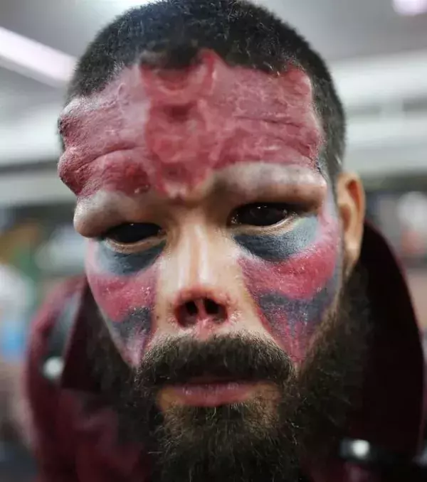 Henry Damon amputierte sich die Nase, um wie Red Skull auszusehen.