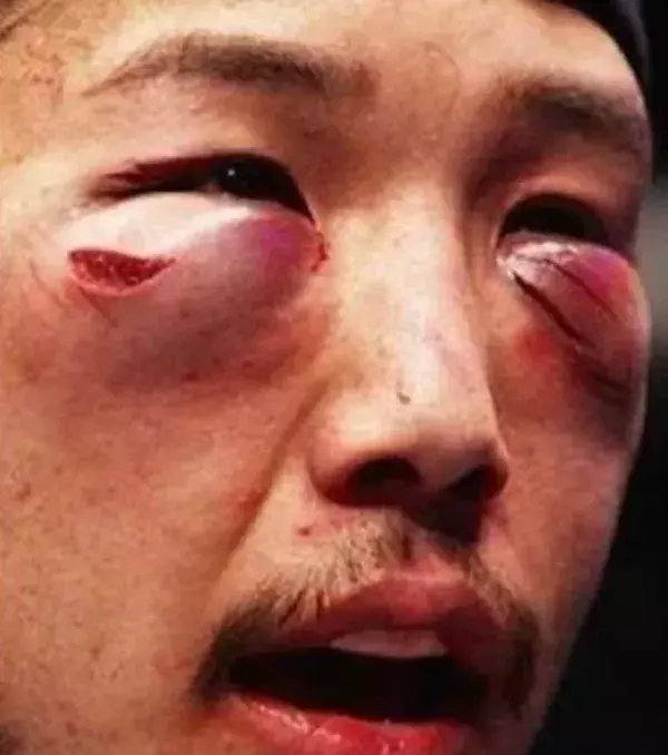 Kazuki Tokudome nach dem Kampf