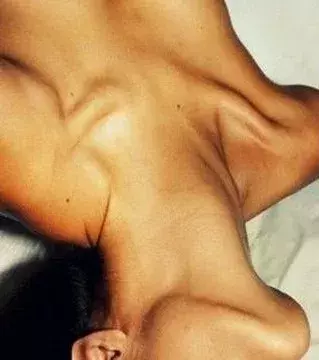 8. Der Nacken