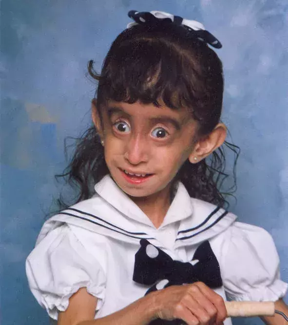 Lizzie Velasquez, die hässlichste Frau der Welt genannt wird, auf dem Foto in ihrem Schulalbum