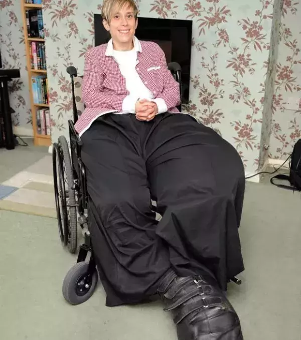 Mandy Sellars aus England leidet an einem einzigartigen Gendefekt. Ihre Beine hören einfach nicht auf zu wachsen.