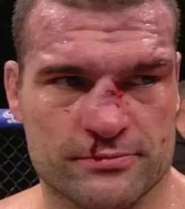 Mauricio Rua nach dem Kampf