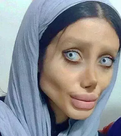 Sahar Tabar hat 50 Schönheitsoperationen hinter sich, weil sie aussehen will, wie Angelina Jolie