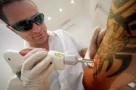 Tattoo-Entfernung: Geht zum Hautarzt eurer Wahl und informiert euch, ob die Krankenkasse die Kosten übernimmt