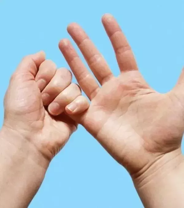 Der kleine Finger: Nervosität, Stress und Selbstvertrauen hängen mit ihm zusammen. Drückt ihn 5 Minuten lang und denkt an etwas anderes.