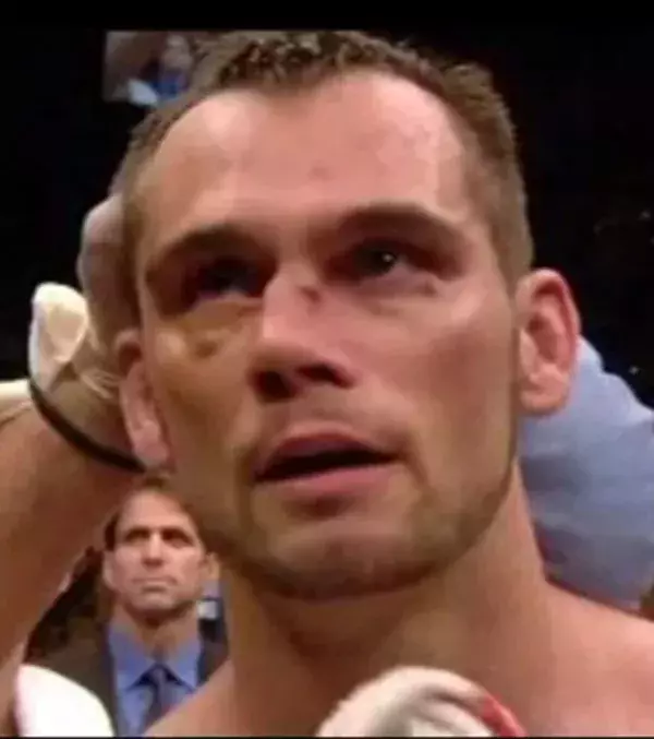 UFC 64 - Rich Franklin's Nase nach einem Kniestoß 2006