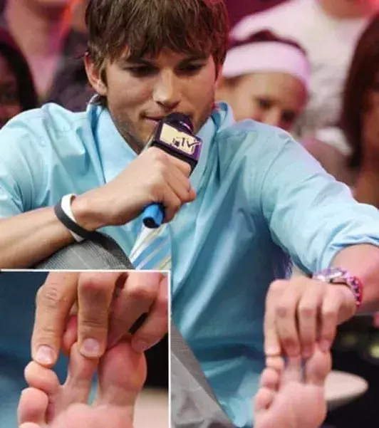 Ashton Kutcher hat Schwimmhäute am linken Fuß