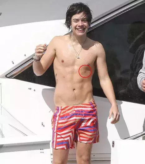 Harry Styles von One Direction hat nicht zwei Brustwarzen, sondern vier!