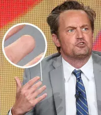 Matthew Perry hat einen Teil seines Mittelfingers an der rechten Hand verloren. Als er noch ein Kind war, steckte der Finger in einer Tür fest.