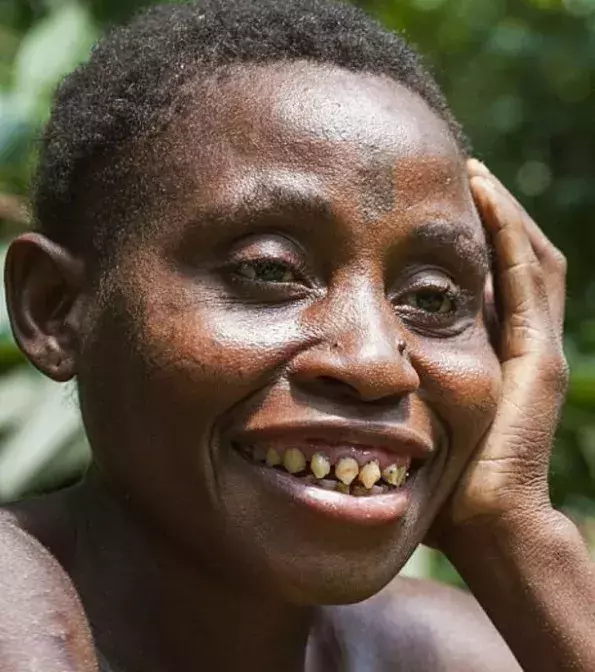 Beim Pygmäenvolk der Baka in Kamerun werden die Zähne spitz gefeilt, um Tiere nachzuahmen.